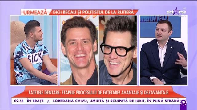 Fațetele dentare, etapele procesului de fațetare! Avantaje și dezavantaje. Cum alegem modelul potrivit