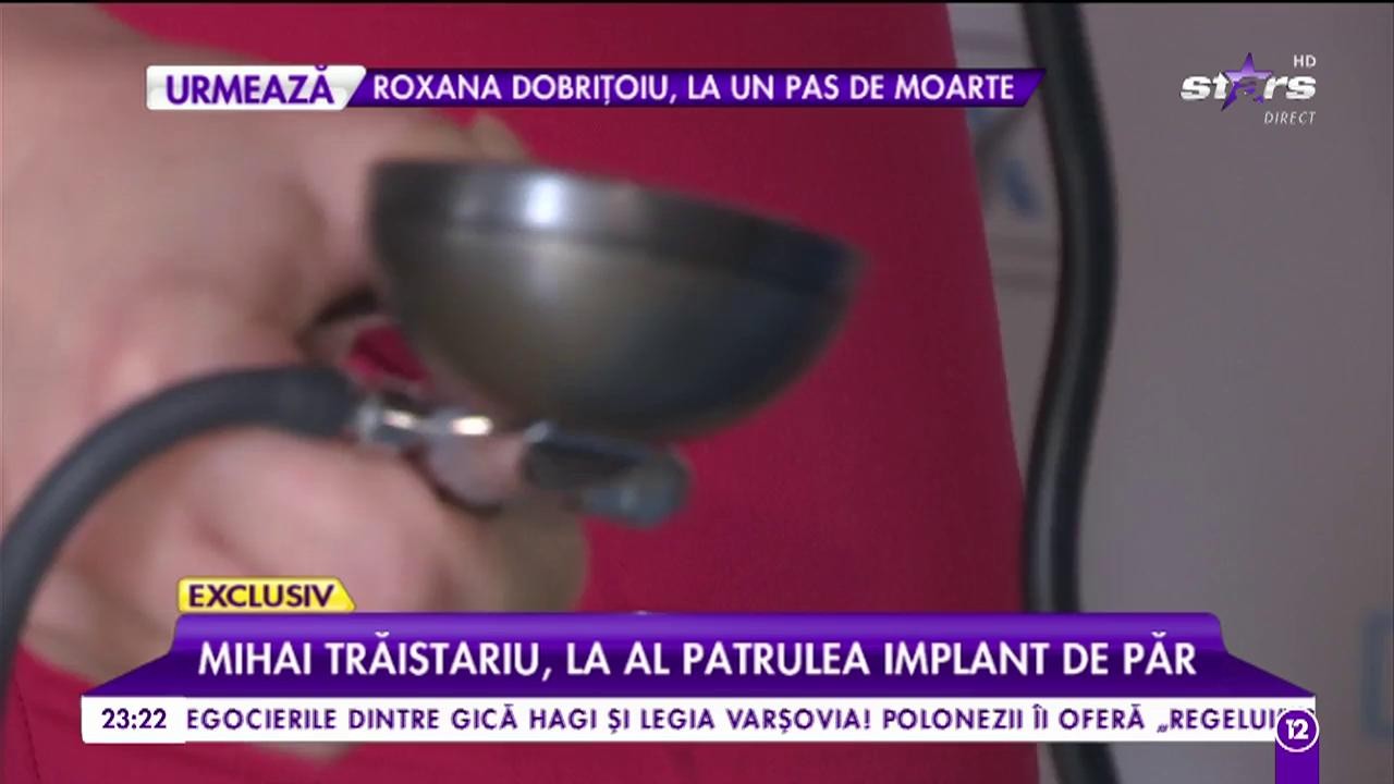 Mihai Trăistariu, din nou pe masa de operație. Artistul, la al patrulea implant de păr