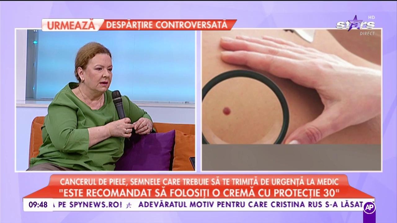 Cancerul de piele, tratament și prevenție: ”Expunerea solară nu este sănătoasă”