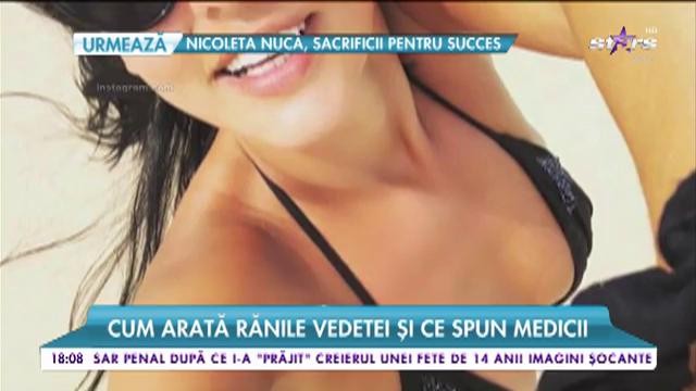 Imagini incendiare cu vedetele &icirc;n ținute minuscule