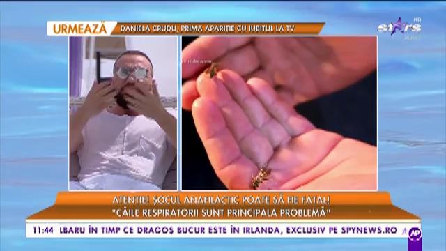 Măsurile de prim ajutor &icirc;n caz de șoc anafilactic: &bdquo;Trebuie să se deschidă căile respiratorii de urgență&rdquo;