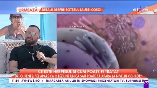 Tot ce trebuie să ştii despre herpes: ce este, de ce apare, dar şi cum să &icirc;l tratezi rapid! Medicul specialist &icirc;ţi dă toate detaliile, &icirc;n direct!