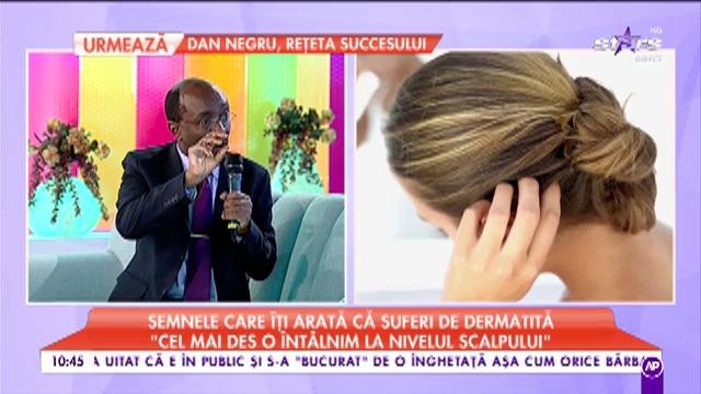 M&acirc;ncărime, usturimi, piele roșie, c&acirc;teva dintre simptomele dermatitei seboreice