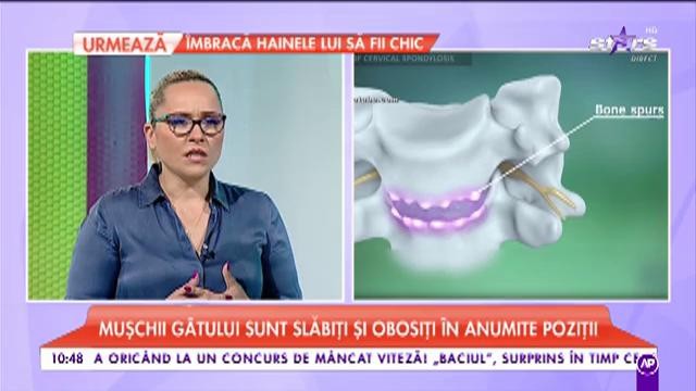 Spondiloza cervicală  - simptome, cauze şi tratament