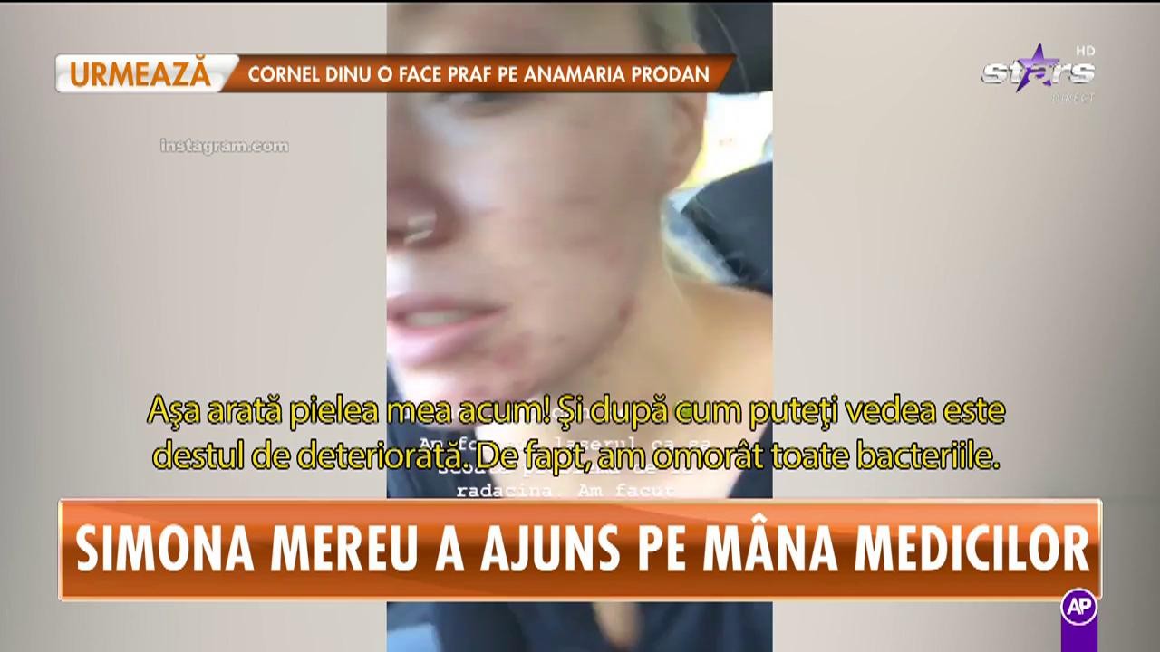 Simona Mereu a ajuns pe m&acirc;na medicilor. Dansatoarea preferată a artiștilor are probleme grave cu tenul