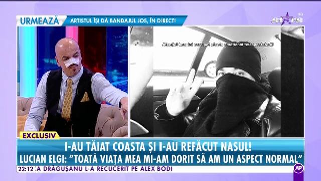 Lucian Elgi, cântăreţul care făcea ravagii în anii 90', prima apariţie într-un platou de televiziune după ce a fost operat la nas