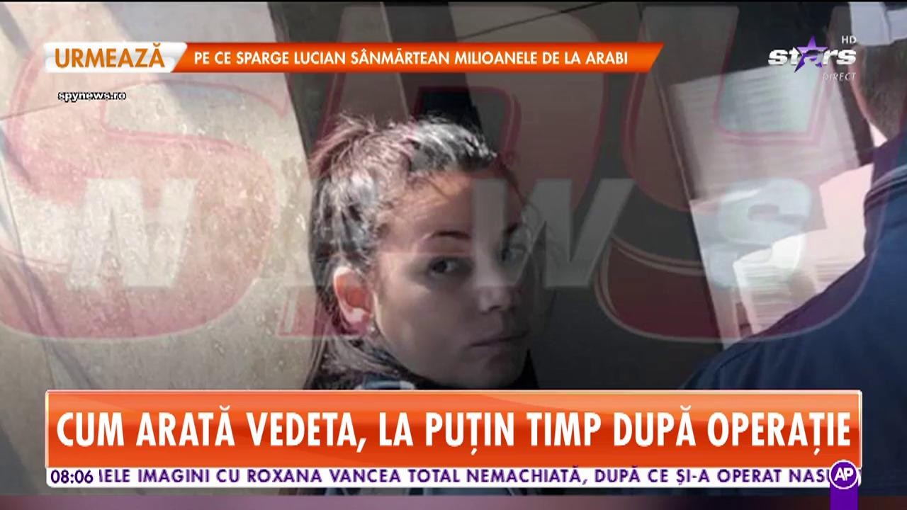 Primele imagini cu Roxana Vancea, după ce și-a operat nasul