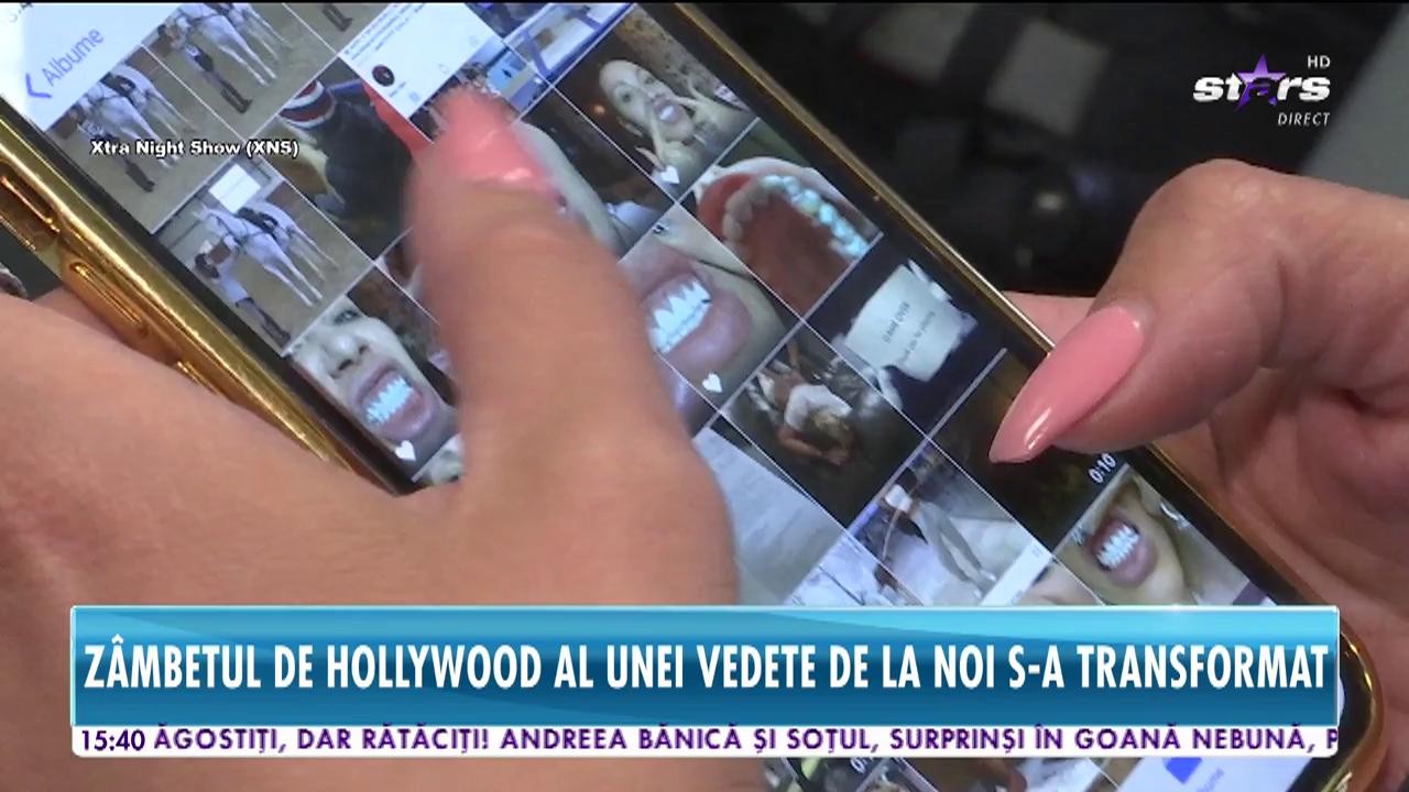 Raluca Podea &icirc;și lipește dinții căzuți cu adeziv