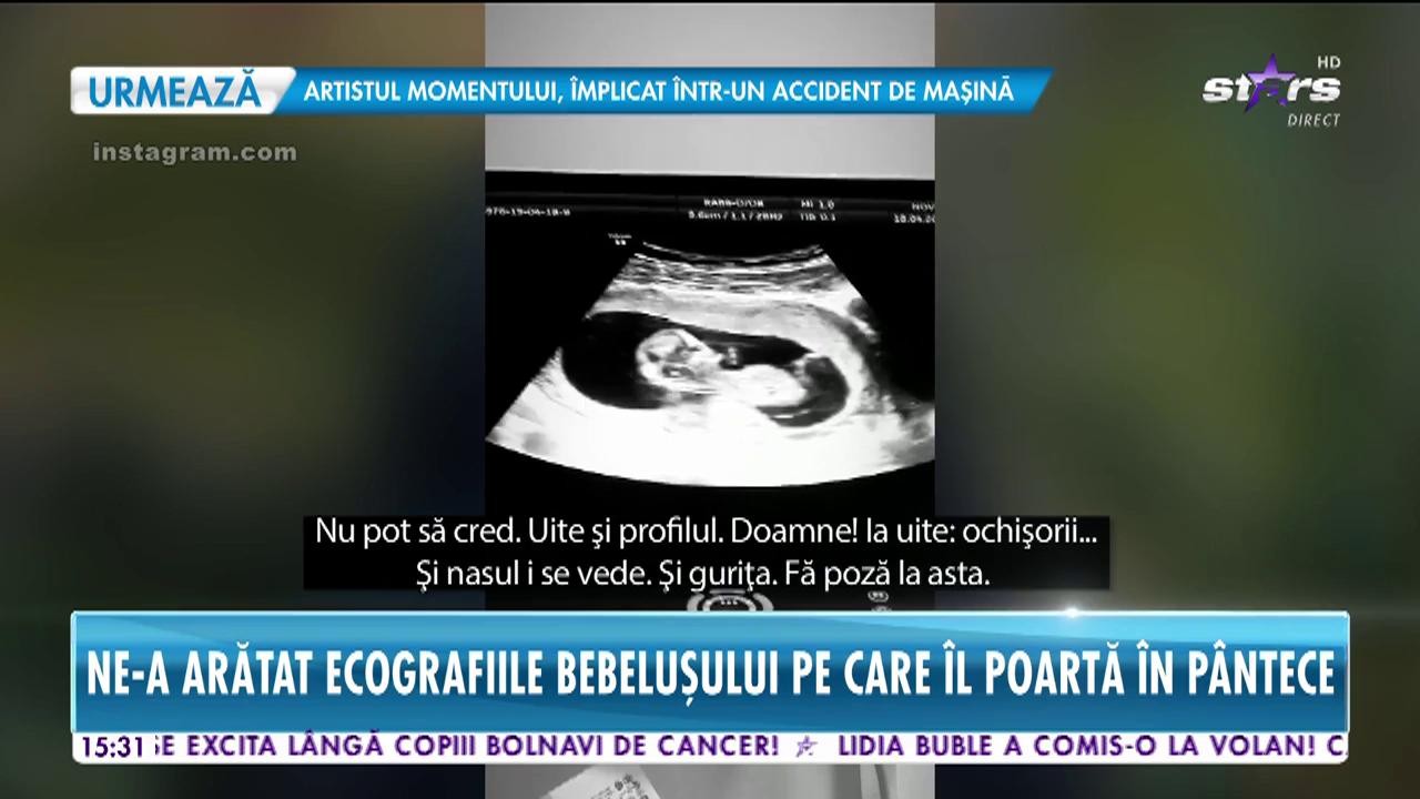 Ioana Grama a arătat ecografiile bebeluşului pe care &icirc;l poartă &icirc;n burtică