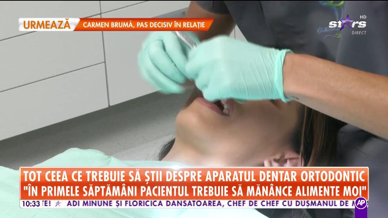 Star Matinal. Vrei să &icirc;ţi pui aparat dentar pentru a avea dinţi perfecţi? Iată care sunt avantajele şi dezavantajele acestui procedeu medical