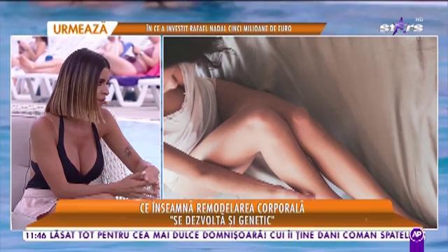 Star Matinal. Ce &icirc;nseamnă remodelarea corporală! Specialistul ne spune care este metoda eficientă care ne scapă de celulită