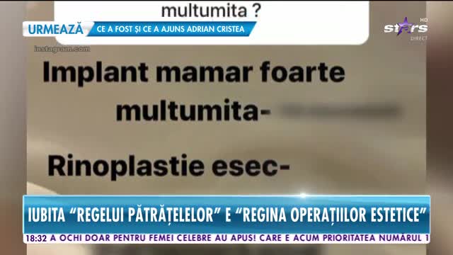 Star News. Inventarul operațiilor estetice ale iubitei lui Dorian Popa