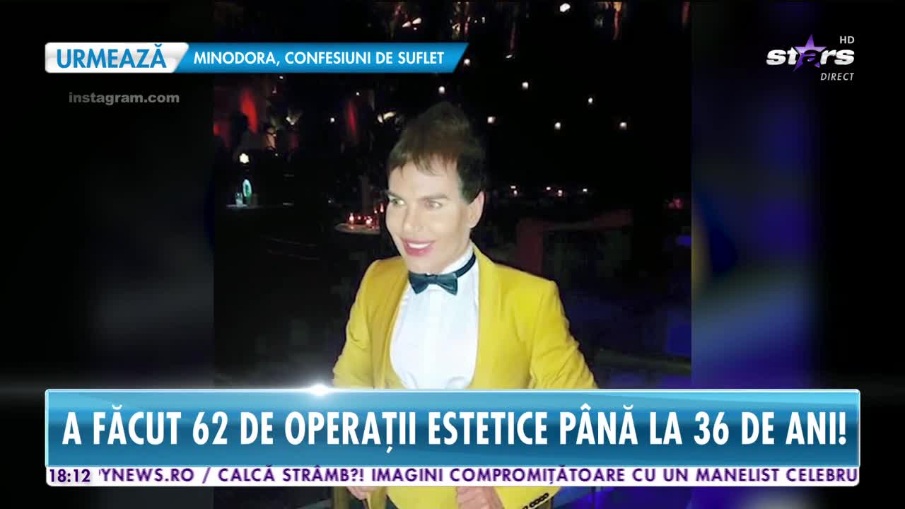 Star News. Păpușa Ken a devenit Barbie! Brazilianul a făcut 62 de operații estetice p&acirc;nă la 36 de ani