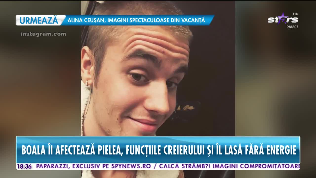 Star News. Justin Bieber se luptă cu o maladie incurabilă. Boala &icirc;i afectează funcțiile creierului!