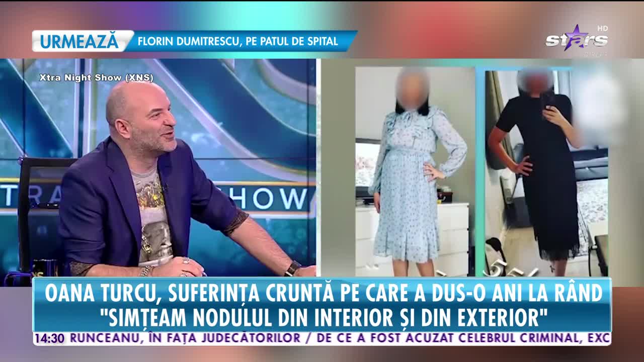 Oana Turcu, suferință cruntă pe care a dus-o ani la r&acirc;nd